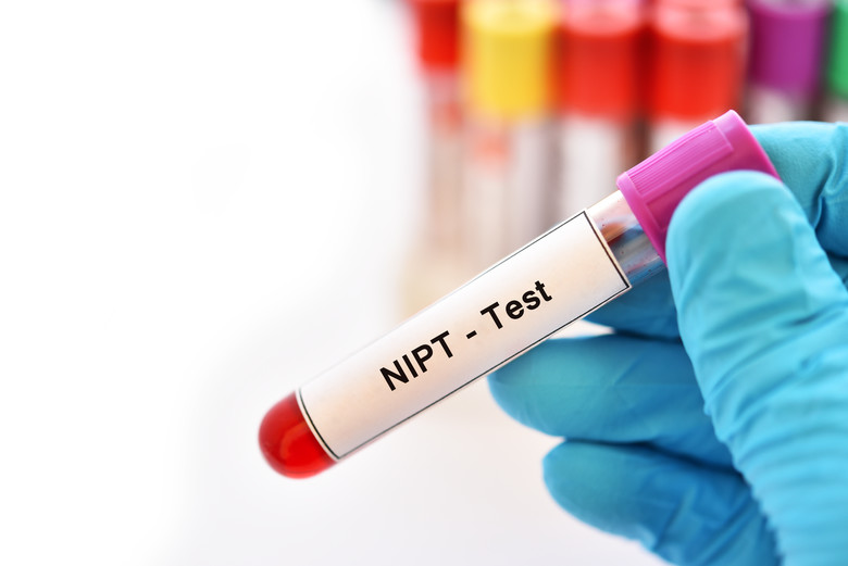 nipt