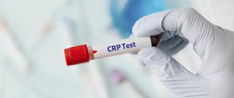crp test