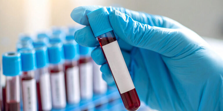 تست خون
