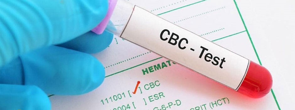 cbc