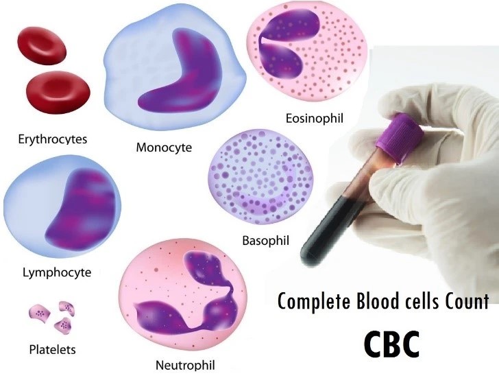 cbc